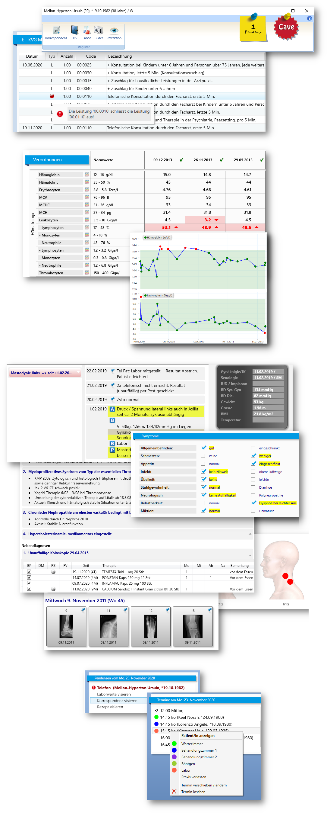 Produkt pex II